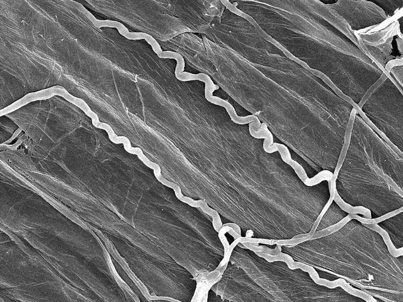 Microscopic image of Epicloe coenophialum by Nick Hill, UGA